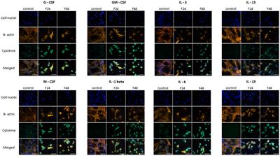 The effect of infection with the entomopathogenic fungus Conidiobolus coronatus (Entomopthorales) on eighteen cytokine-like proteins in Galleria mellonella (Lepidoptera) larvae